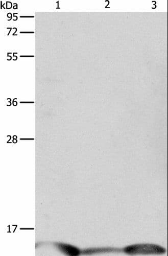PFN1 / Profilin 1 Antibody