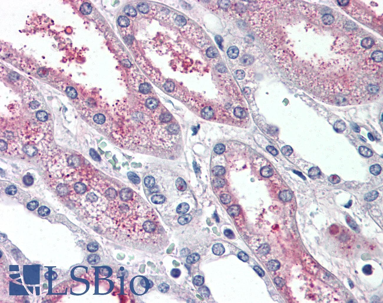 IHC-plus™ SUSD2 Antibody (Internal)