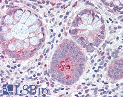 IHC-plus™ Polyclonal Rabbit anti-Human RNF128 / GRAIL Antibody (IHC, WB)