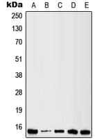 LGALS1 / Galectin 1 Antibody (Internal)