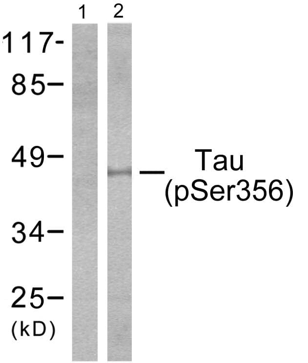 Polyclonal Rabbit anti-Human MAPT / Tau Antibody (phospho-Ser356, IHC, WB)