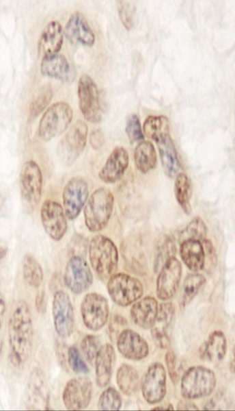 Polyclonal Rabbit anti-Human QSER1 Antibody (aa175-225, IHC, WB)