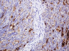 TAG-72 Antibody (clone CC49)