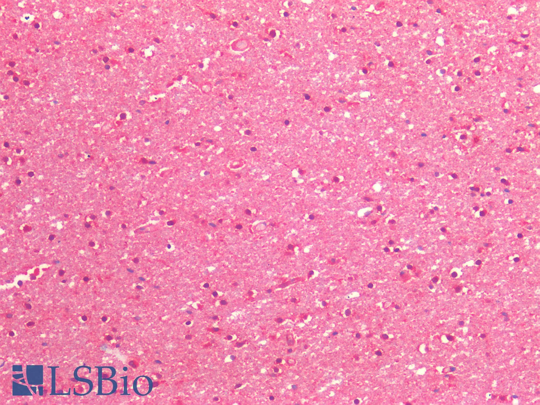 PathPlus™ Monoclonal Mouse HTT / Huntingtin Antibody (clone HDC8A4, aa2703-2911, IHC, WB)