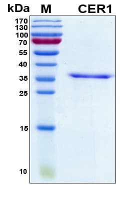 Human CER1 Protein (Recombinant His, N-Terminal)