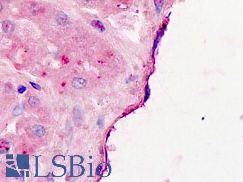 IHC-plus™ Polyclonal Rabbit anti-Human VEGFA / VEGF Antibody (IHC)