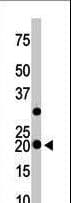 HPCAL1 / Hippocalcin-Like 1 Antibody (aa2-32)