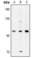 ELP2 / STATIP1 Antibody