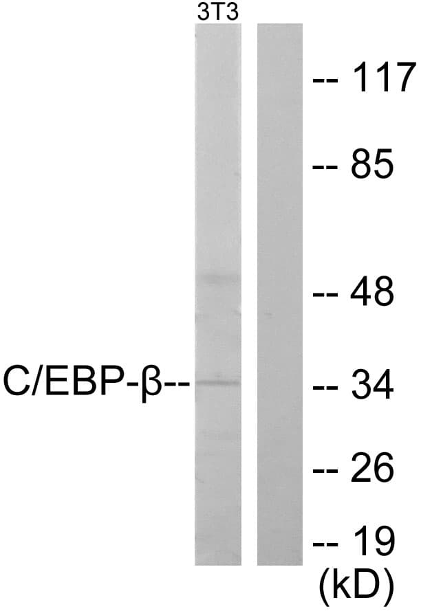 C/EBP Beta / CEBPB Antibody (aa201-250)