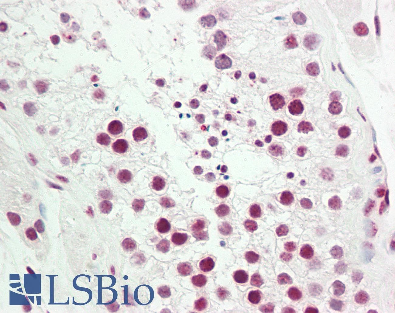 IHC-plus™ COUP-TFII / NR2F2 Antibody (aa1-30)