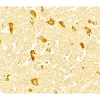 DPF3 Antibody