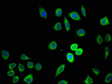 Polyclonal Rabbit anti-Human ZDHHC1 Antibody (IHC, IF, WB)