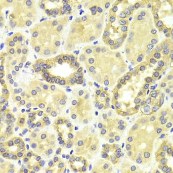 MAP2K2 / MKK2 / MEK2 Antibody