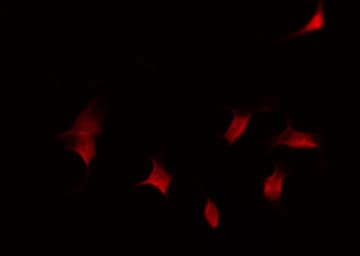 AML1 / RUNX1 Antibody (phospho-Ser276)