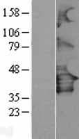 P2RY12 / P2Y12 Protein (Over-Expression Lysate Myc-DDK (Flag))