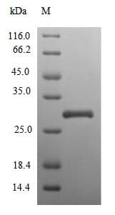 Human SPRR3 Protein (Recombinant 6His-SUMO, N-terminus)