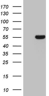 ESRRA / ERR Alpha Antibody (aa1-205, clone OTI3E3)