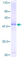 Human SERPINB5 / Maspin Protein (Recombinant GST)