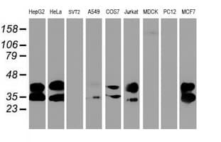 UNG / Uracil DNA Glycosylase Antibody (clone OTI1G2, Carrier-free)