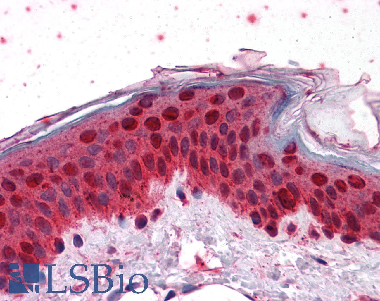 IHC-plus™ HOXB7 Antibody (clone 4C6)