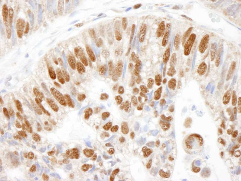 Polyclonal Rabbit anti-Human MCM3 Antibody (aa500-550, IHC, WB)