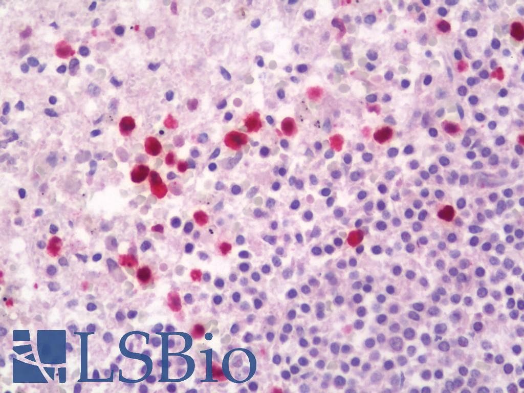 IHC-plus™ HNP-4 / DEFA4 Antibody (aa27-76)