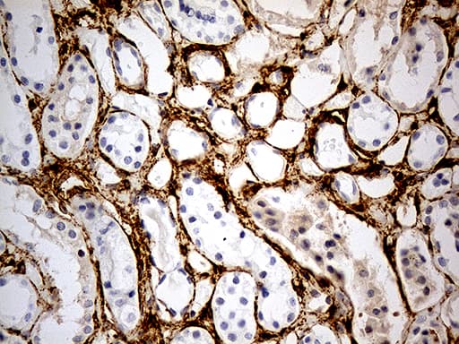 Monoclonal Mouse anti-Human MRC2 / Endo180 Antibody (clone OTI9G4, IHC, WB)