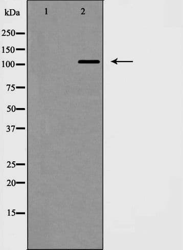 NEP / DDR1 Antibody