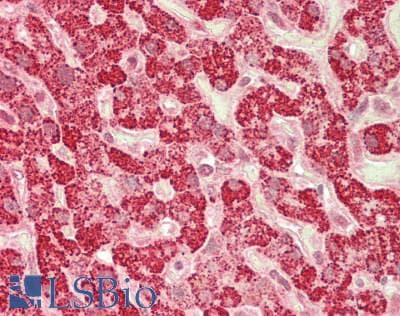 IHC-plus™ Polyclonal Rabbit anti-Human AGO1 / EIF2C Antibody (IHC, WB)
