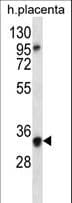 OR6N2 Antibody (aa244-273)