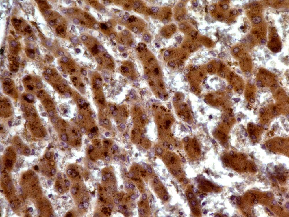 TIA-1 Antibody