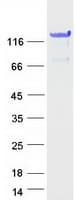 Human TXLNB Protein (Recombinant Myc-DDK (Flag))