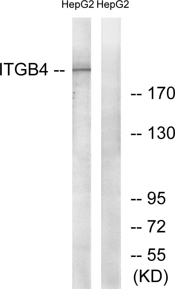 Polyclonal Rabbit anti-Human ITGB4 / Integrin Beta 4 Antibody (aa1481-1530, IHC, WB)