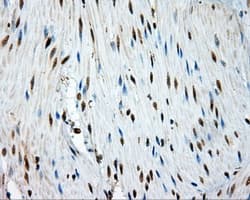 TPMT Antibody (clone OTI2A2)