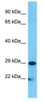 EMA / MUC1 Antibody (aa1192-1241)