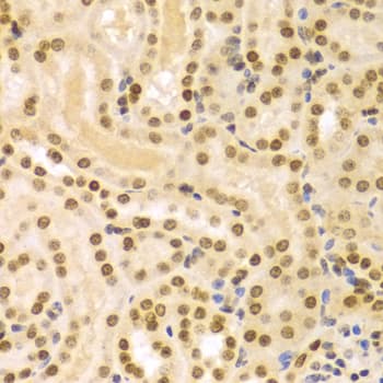 Polyclonal Rabbit anti-Human DKC1 / Dyskerin Antibody (IHC, IF, WB)