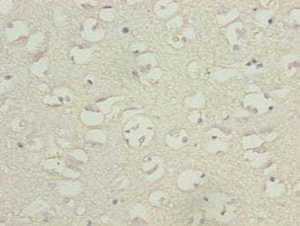TBC1D14 Antibody