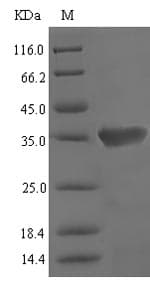 Mouse Lcn3 / Lipocalin 3 Protein (Recombinant 6His-SUMO, N-terminus)