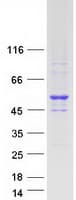 Human NR2E3 / PNR Protein (Recombinant Myc-DDK (Flag))
