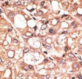 KDM1A / LSD1 Antibody (aa457-490)
