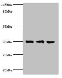 Polyclonal Rabbit anti-Human RPH3AL Antibody (aa1-315, WB)