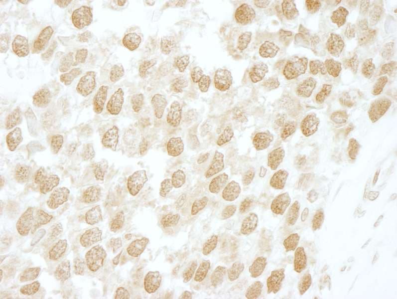 CSNK2B / Phosvitin Antibody (aa100-150)