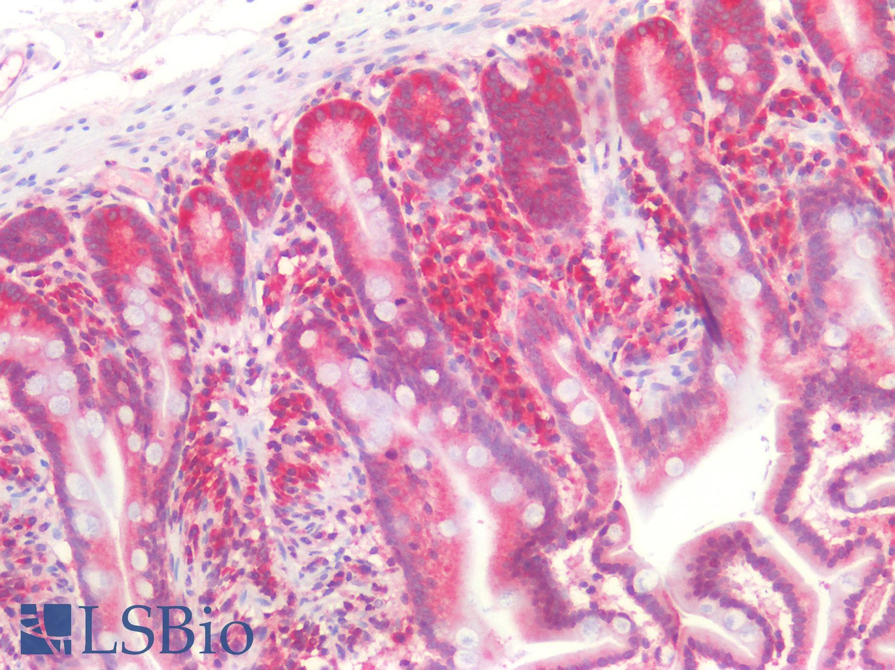 PathPlus™ Polyclonal Rabbit anti-Human SMN1 Antibody (aa45-94, IHC, WB)