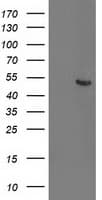 ACY1 / Aminoacylase 1 Antibody (clone OTI2B5)