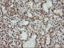 MSI1 / Musashi 1 Antibody (clone OTI2H9, Carrier-free)