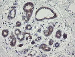 RIOK2 Antibody (aa277-552, clone OTI5D11, Carrier-free)