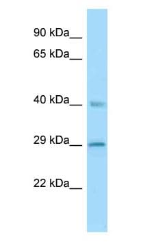SCG5 / 7B2 Antibody (aa70-119)