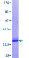 Human FOXP2 Protein (Recombinant GST)