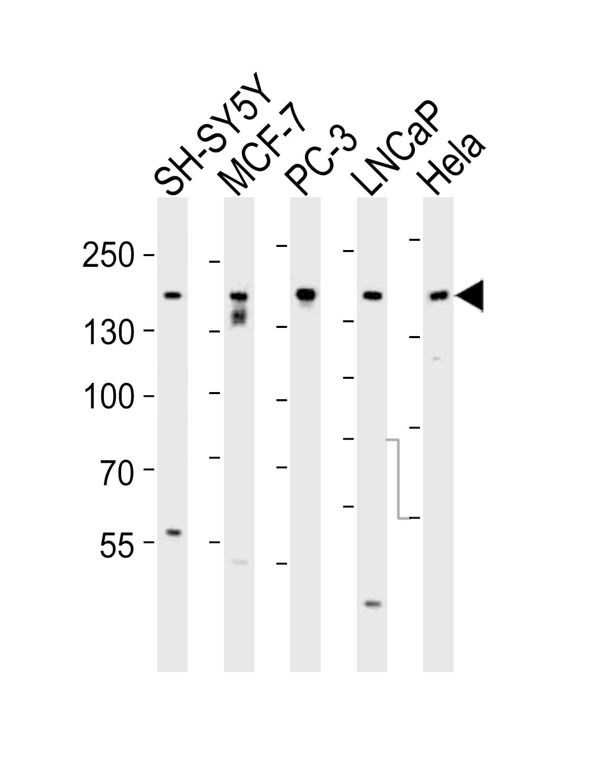 IHC-plus™ Tuberin / TSC2 Antibody (Ser1798)