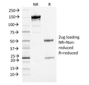 ANO1 / DOG1 / TMEM16A Antibody (clone DG1/1484)
